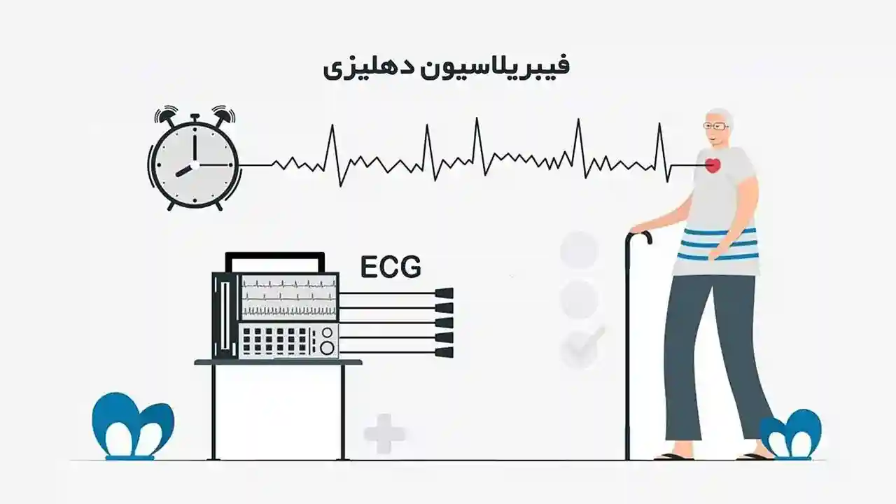 فیبریلاسیون دهلیزی (Atrial fibrillation) چیست؟