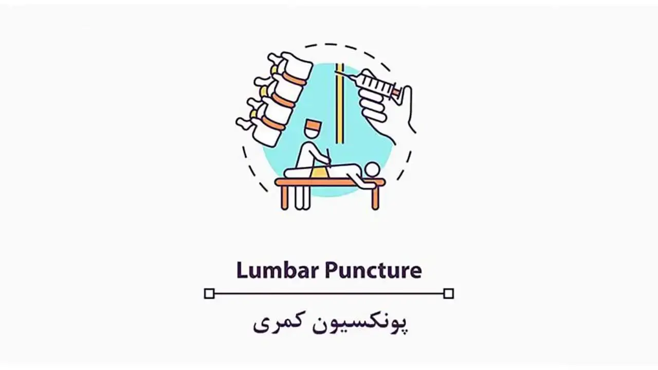 پونکسیون کمری یا Lumbar Puncture - نبض هوشمند سلامت