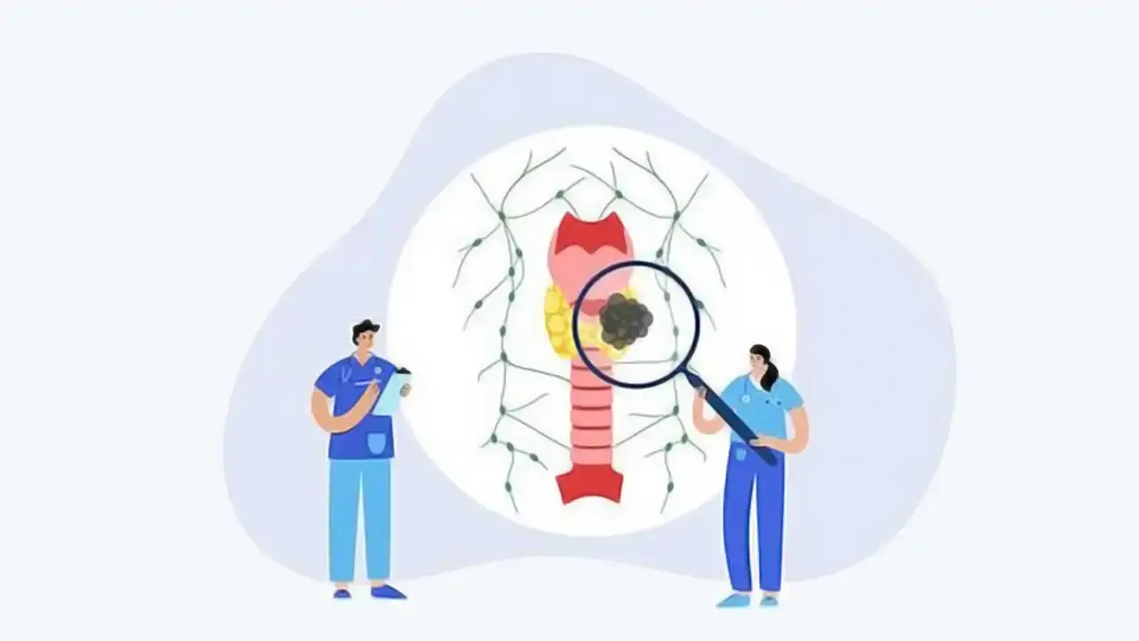 سرطان تیروئید: آنچه زنان باید بدانند - نبض هوشمند سلامت