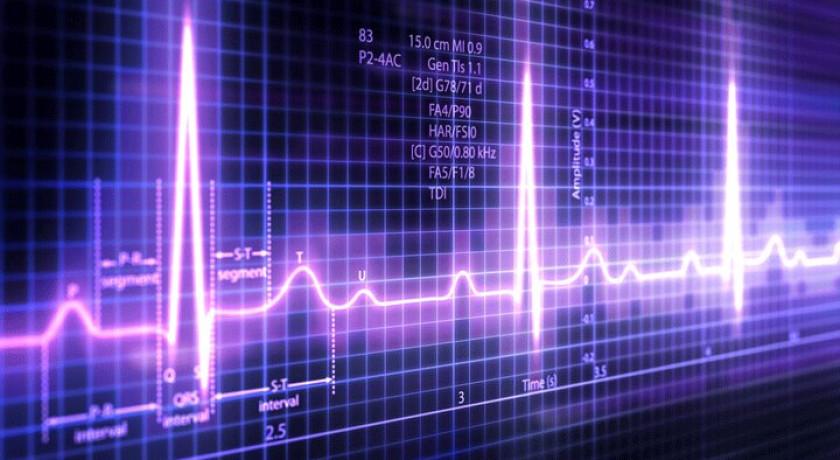 هوش مصنوعی ( AI ) چگونه به ما کمک می‌کند تا نوار قلبی ( ECG ) را تفسیر کنیم!